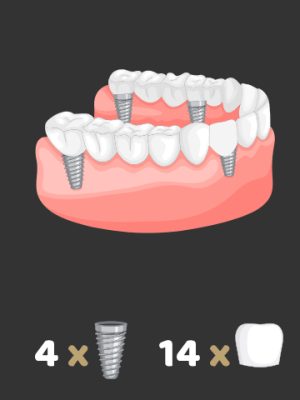 4imp-14cr https://www.euroistanbuldental.com/wp-content/uploads/4imp-14cr-300x400.jpg