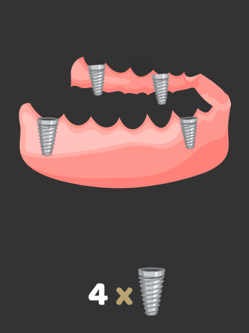 4imp https://www.euroistanbuldental.com/wp-content/uploads/4imp.jpg