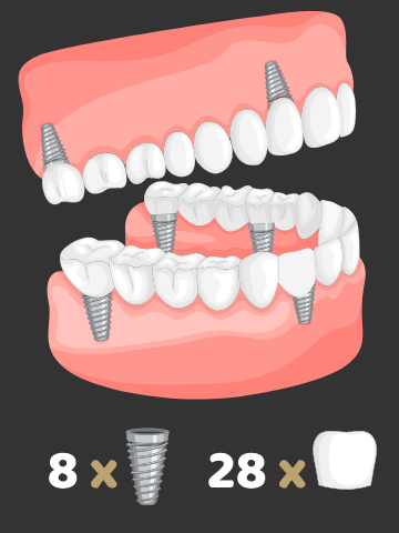8imp-28cr https://www.euroistanbuldental.com/wp-content/uploads/8imp-28cr.jpg