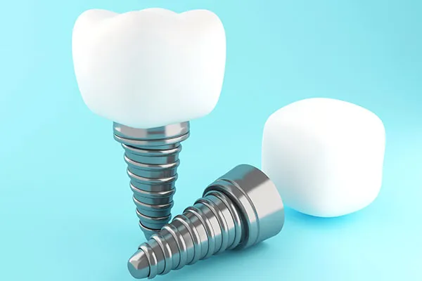dental-implant https://www.euroistanbuldental.com/wp-content/uploads/dental-implant.webp