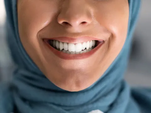 dental-tooth-whitening-list